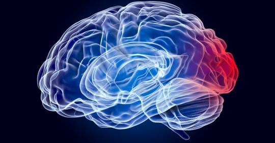 scan of brain injury